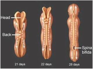 foto-de-neurale-buis